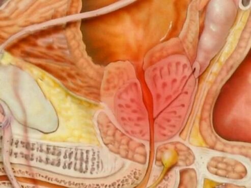 Type de prostate sain d'une personne